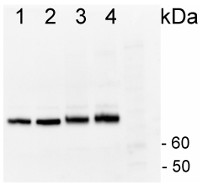HSP70 | Heat shock protein 70 (cytoplasmic) in the group Antibodies Plant/Algal  / Environmental Stress / Heat shock at Agrisera AB (Antibodies for research) (AS08 371)